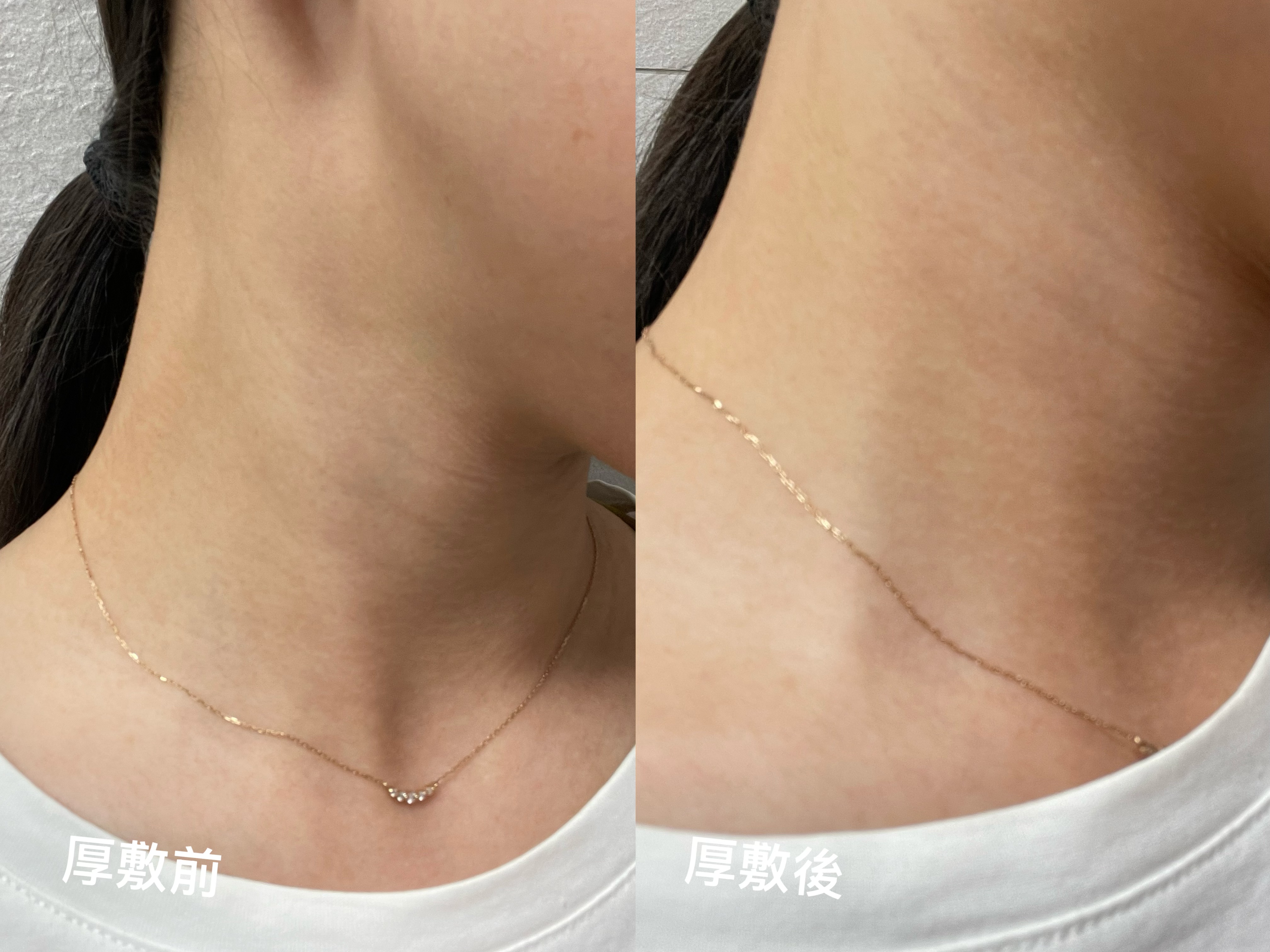 船井生醫 Ido醫朵 黑玫瑰抗老修護系列|修護抗老一次到位,打造澎潤年輕肌,告別疲憊肌! - 第2張圖 Img 1774